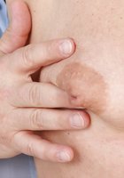 Зрелая дама раздвинула ноги у гинеколога и засунула в вагину смотровое зеркало 2 фото Зрелая дама раздвинула ноги у гинеколога и засунула в вагину смотровое зеркало 2 фото